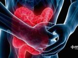 La inflamación intestinal acecha a muchos pacientes reumatológicos