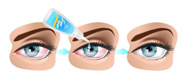 Plata coloidal para los ojos: ¿combate las infecciones oculares?